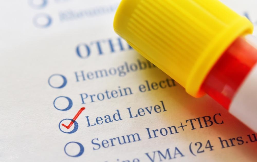 leaded petrol, lead blood test, lead level blood test