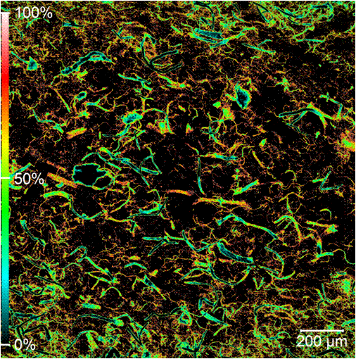 Nanocellulose under a microscope.