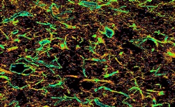 Nanocellulose: Rediscovering Forest Resources