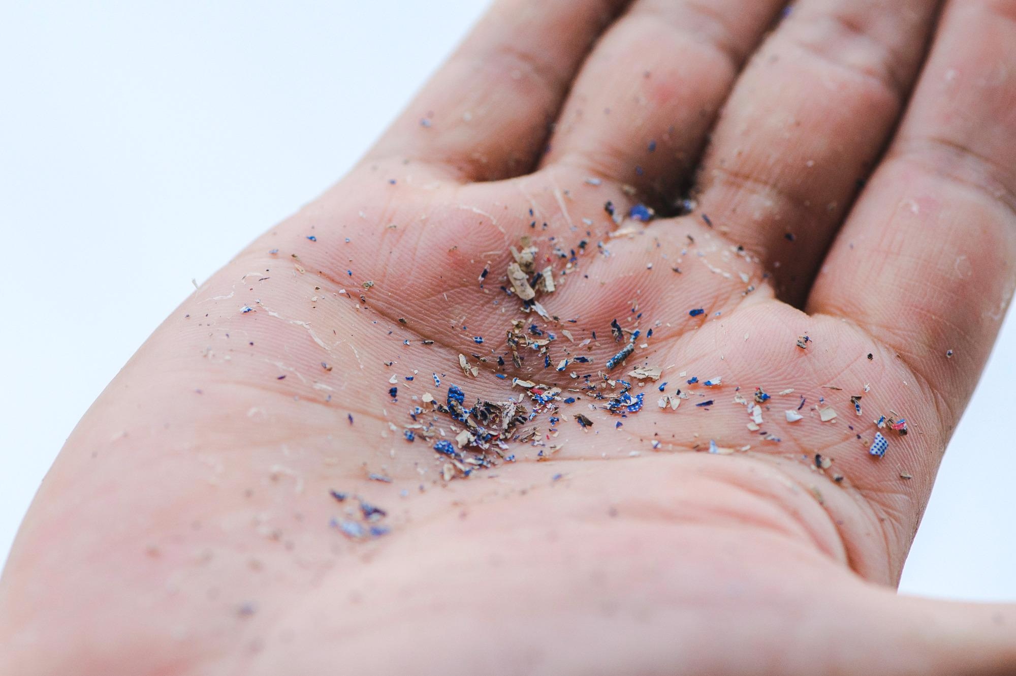 Study Determines the Abundance of Microplastics in an Alluvial Rhine Soil.