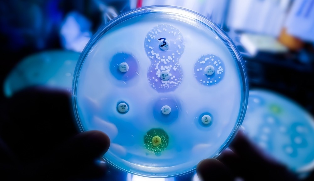 microbes