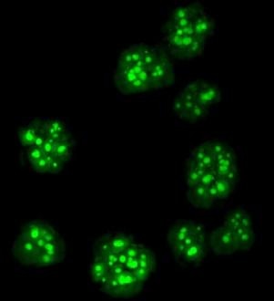 Carbon Storage Signaling Mechanism Discovered in Algae