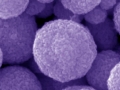 Dramatic Improvement in Cheap Solar Cells Now Being Developed in Laboratories