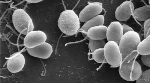 New Research Instills Hope of Efficient Hydrogen Production Using Green Algae