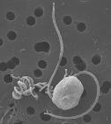 Researchers Sequence Genome of Ecologically Important and Plentiful Algae