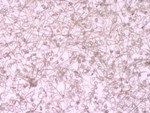 Research Demonstrates Impact of Climate Change on Treatment & Prevention of Parasite Infections