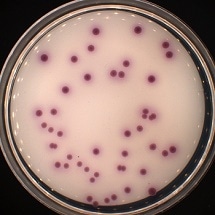 Summer Heatwaves Causing Potential Pathogenic Bacteria to Spread