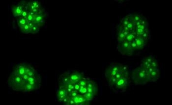 Carbon Storage Signaling Mechanism Discovered in Algae