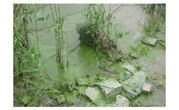 Global Shift in Phosphorus–Nitrogen Balance in Water Favors Nitrogen
