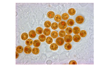 Low Iron Levels and Warming Ocean Waters Impair Growth of Microalgae Living in Coral Cells