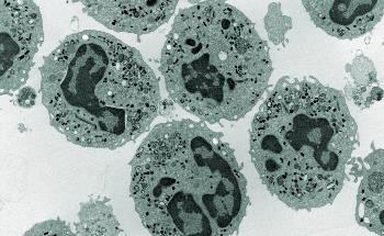 Researchers Study How Corals React to Changing Environmental Conditions