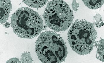Crystallization Rate of Coral Skeletons is Correlated with Resilience to Ocean Acidification