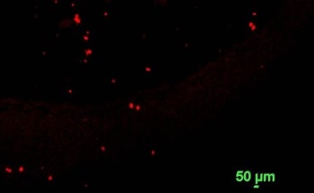 Mass Quantification of Atmospheric Microplastics in Auckland