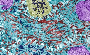 Engineered Bacteria Could Provide a Powerful Route to Sustainable Biochemicals