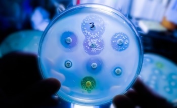 New Study Highlights Microbes' Role in Achieving UN SDGs